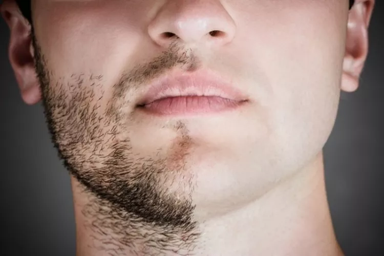 Mythes de la barbe chez les adolescentes 